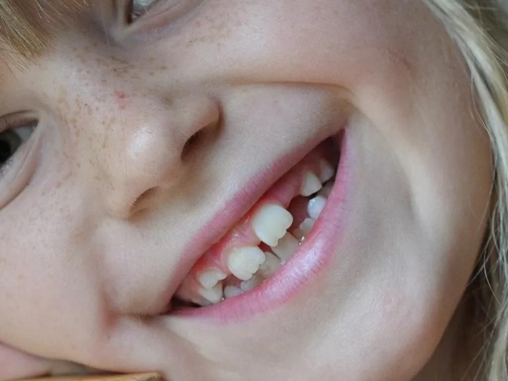Ilustrasi gigi anak-anak (Pixabay)