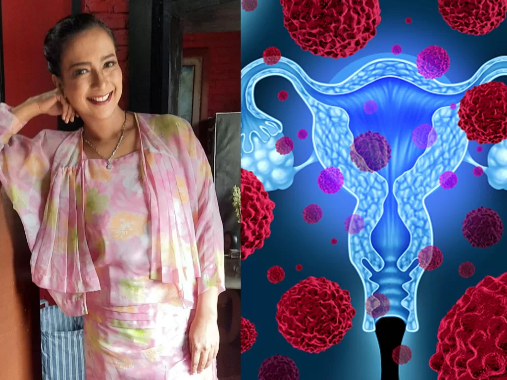 Kolase foto Shahnaz Haque dan ilustrasi kanker ovarium (Instagram/shahnaz.haque/Mohammed Haneefa Nizamudeen)