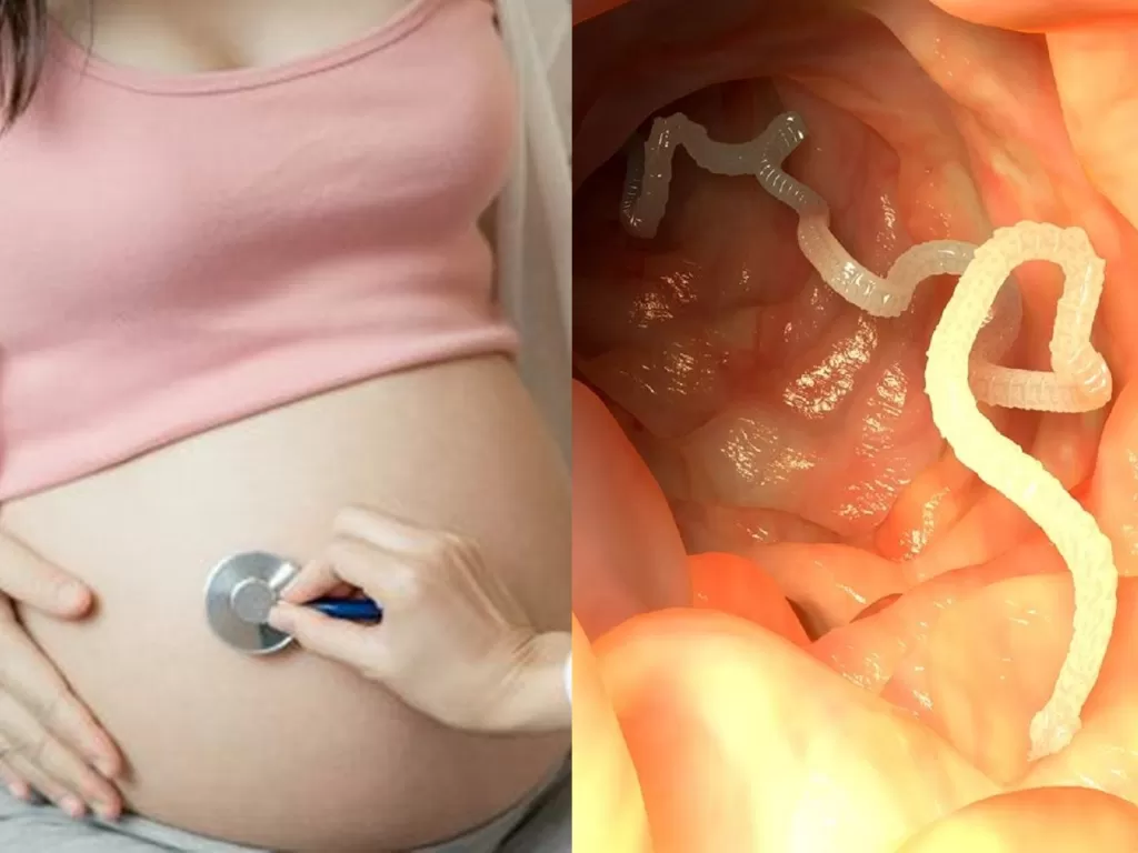 Kiri: Ilustrasi wanita hamil cacingan (Freepik/Biancoblue), kanan: ilustrasi cacing kremi. (Youtube/Natural Cures)