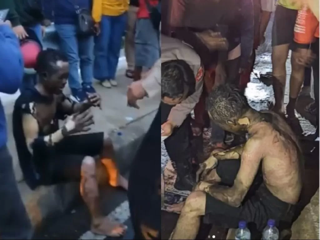 Pria nekat bakar diri di Depok yang masih selamat. (Instagram/@forumwartawanpolri).