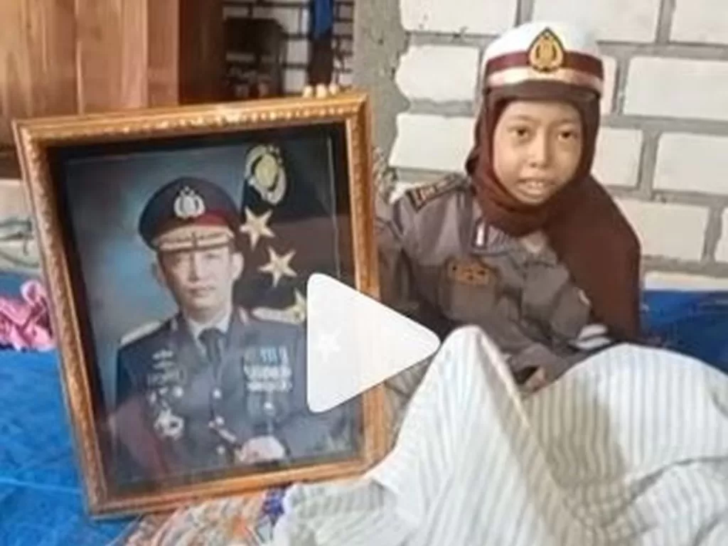 Sinta Aulia, anak penderita tumor tulang yang ingin bertemu Kapolri Jenderal Pol Listyo Sigit Prabowo. (Instagram/@hotmanparisofficial)