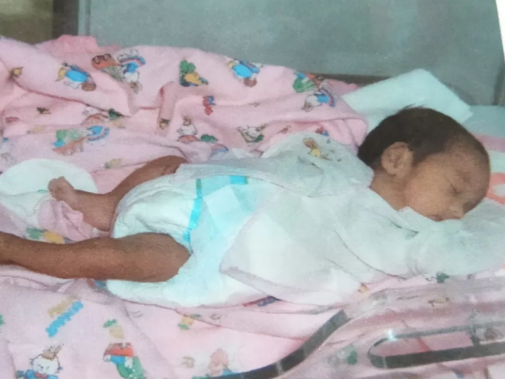 Seorang bayi terlahir prematur. (Rachel Putri Aurelya Siloam/IDZ Creators)