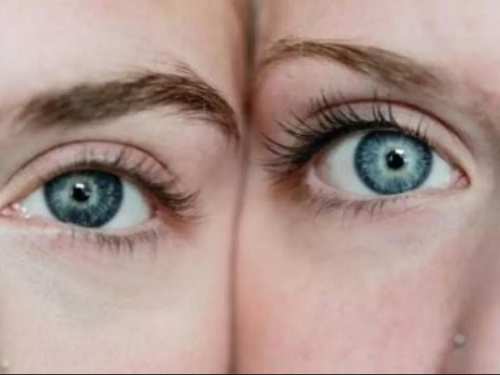 Perbedaan warna mata manusia. (freepik)