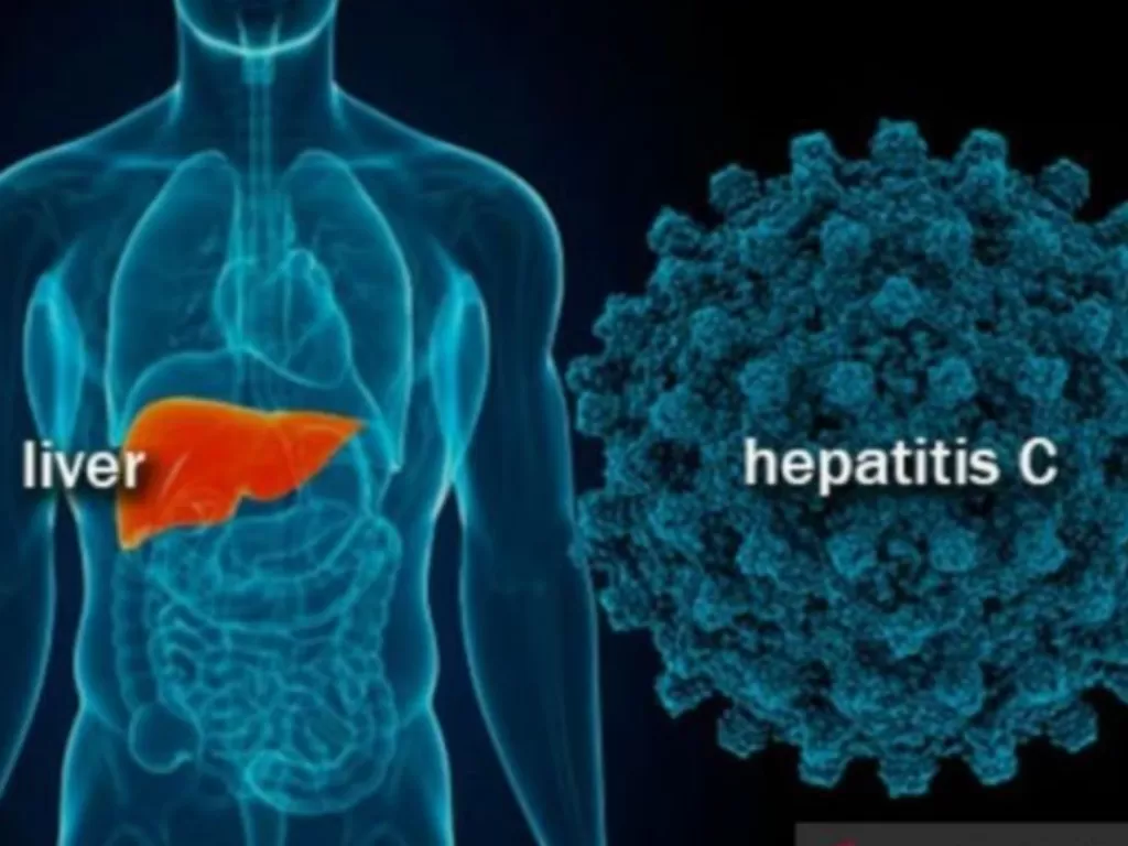 Ilustrasi - Penyakit hepatitis. (FOTO ANTARA/HO-RSUD Kota Bogor).