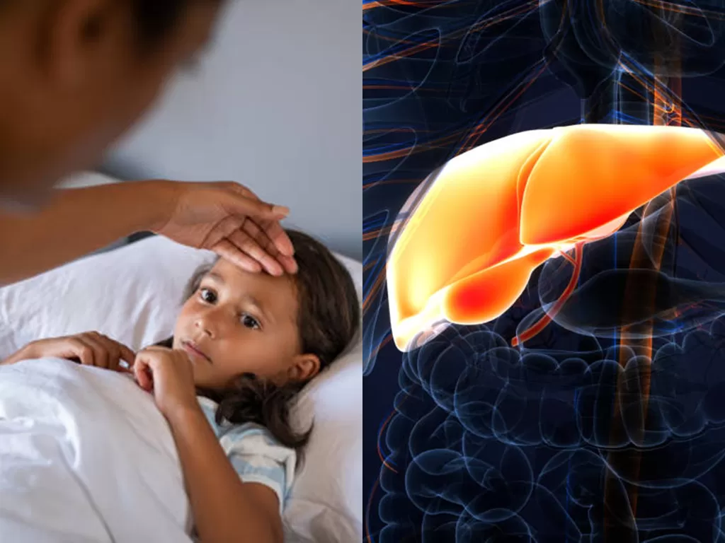 Kolase anak sakit dan ilustrasi hepatitis (Unsplash/Stock photo and footage/magicmine)