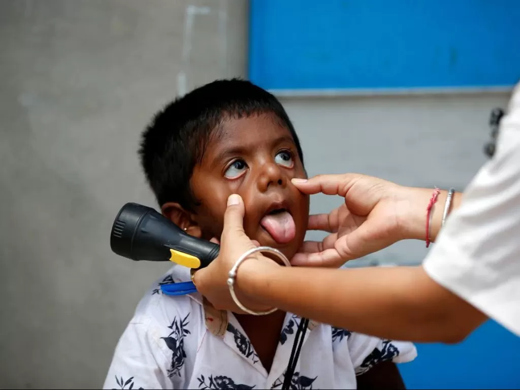 Ilustrasi - Seorang petugas kesehatan memeriksa seorang anak di tengah penyebaran penyakit virus corona (COVID-19), di sebuah desa di pinggiran Ahmedabad, India, 9 Juni 2021. (REUTERS/Amit Dave)