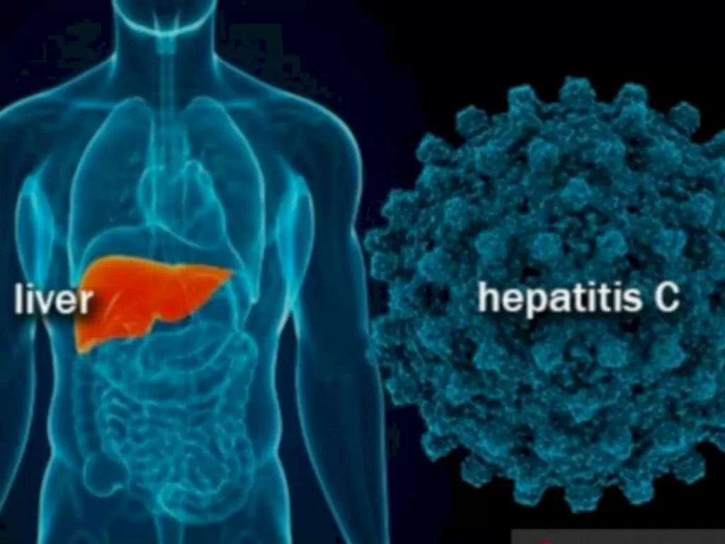 Ilustrasi Penyakit hepatitis. (FOTO ANTARA/HO-RSUD Kota Bogor)