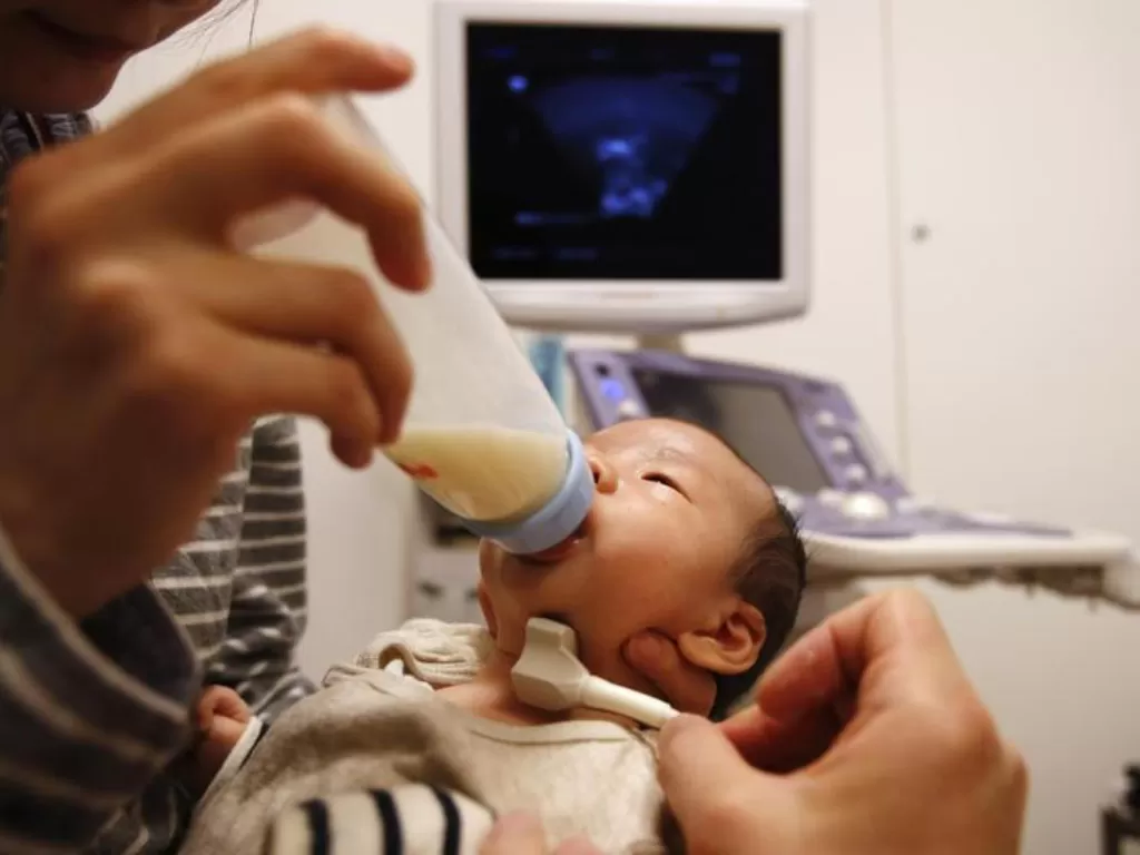 Bayi di Jepang sedang diberikan susu dari botol. (REUTERS)