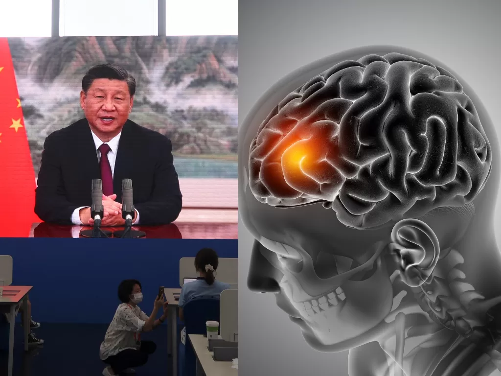 Presiden China idap aneurisma otak. (REUTERS/Kevin Yao/Freepik)