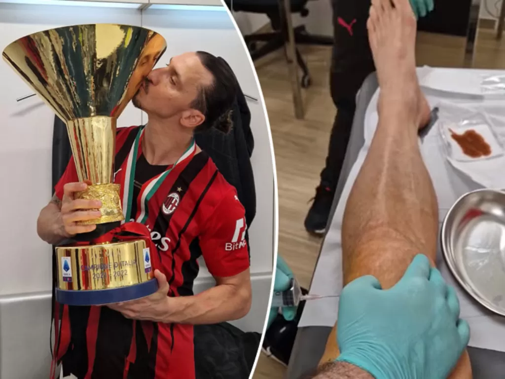 Kiri: Zlatan Ibrahimovic berpose dengan trofi Liga Italia Serie-A. / Kanan: Proses penyuntikan di lutut Zlatan yang rutin dilakukan. (Instagram/iamzlatanibrahimovic)