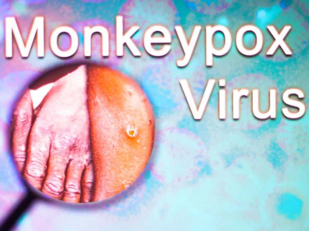 Ilustrasi virus cacar monyet (Unsplash/RafaPress)