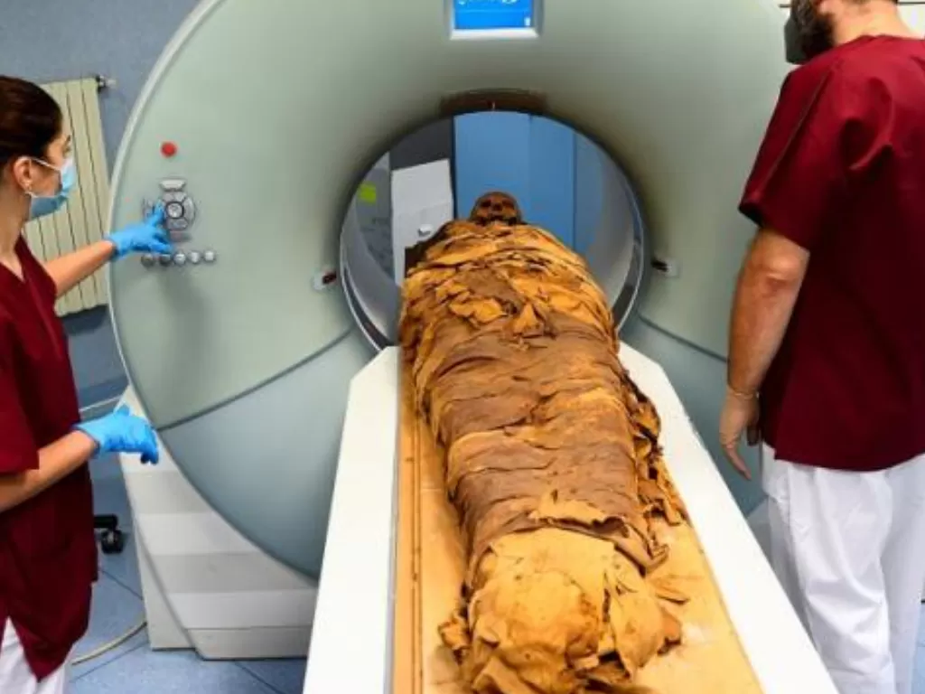 Ilustrasi - Teknisi radiologi medis menyiapkan CT scan untuk melakukan pemeriksaan radiologi pada mumi Mesir guna menyelidiki sejarahnya di rumah sakit Policlinico di Milan, Italia, 21 Juni 2021. (Reuters)