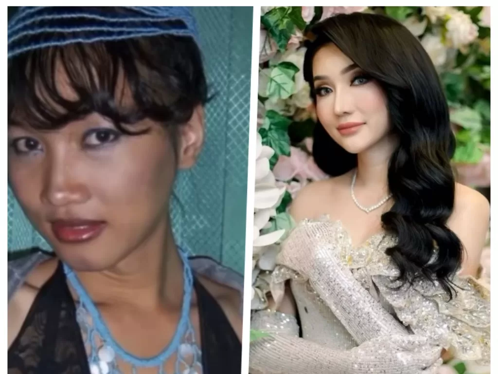 Viral Video Before-After Oplas Lucinta Luna, Netizen Ribut Pertanyakan Asal  Duitnya - Indozone Seleb