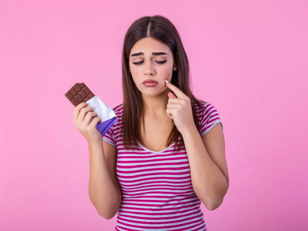 Cokelat, makanan yang menyebabkan jerawat (freepik.com)