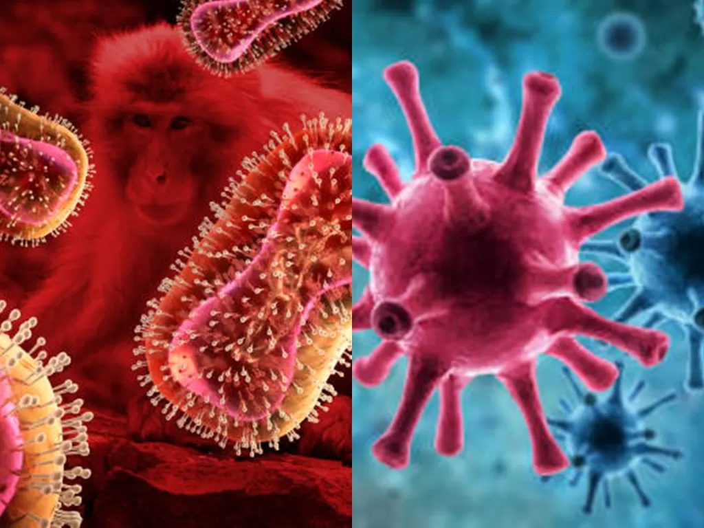 Ilustrasi virus cacar monyet dan COVID-19 (Freepik)