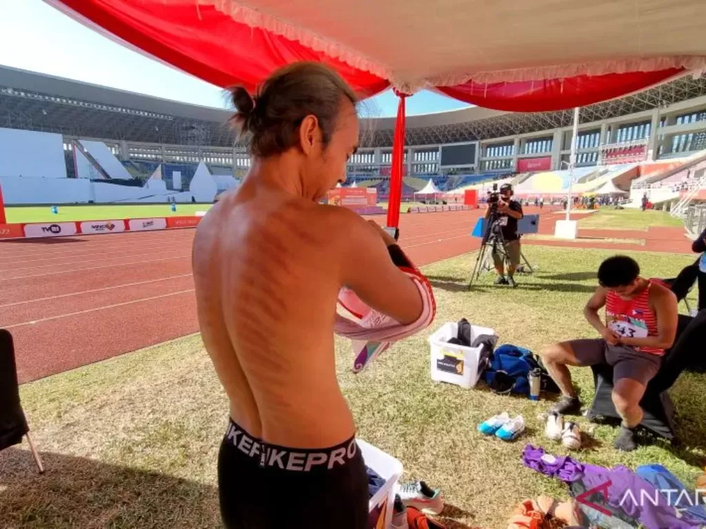 Atlet lompat jauh Indonesia Setiyo Budi Hartono menunjukkan punggungnya bekas kerokan usai menyelesaikan lomba ASEAN Para Games 2022 di Stadion Manahan, Solo, Jumat (5/8/2022). (ANTARA/Bayu Kuncahyo)