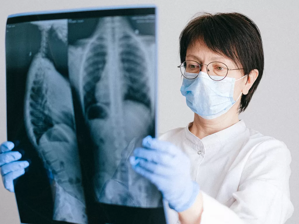 Ilustrasi dokter memeriksa rontgen paru. (Pexels/Anna Shvets)