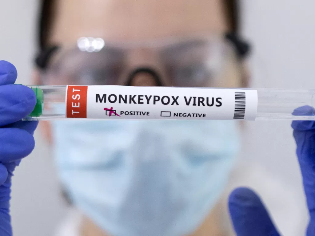 Ilustrasi virus cacar monyet. (REUTERS/Dado Ruvic)