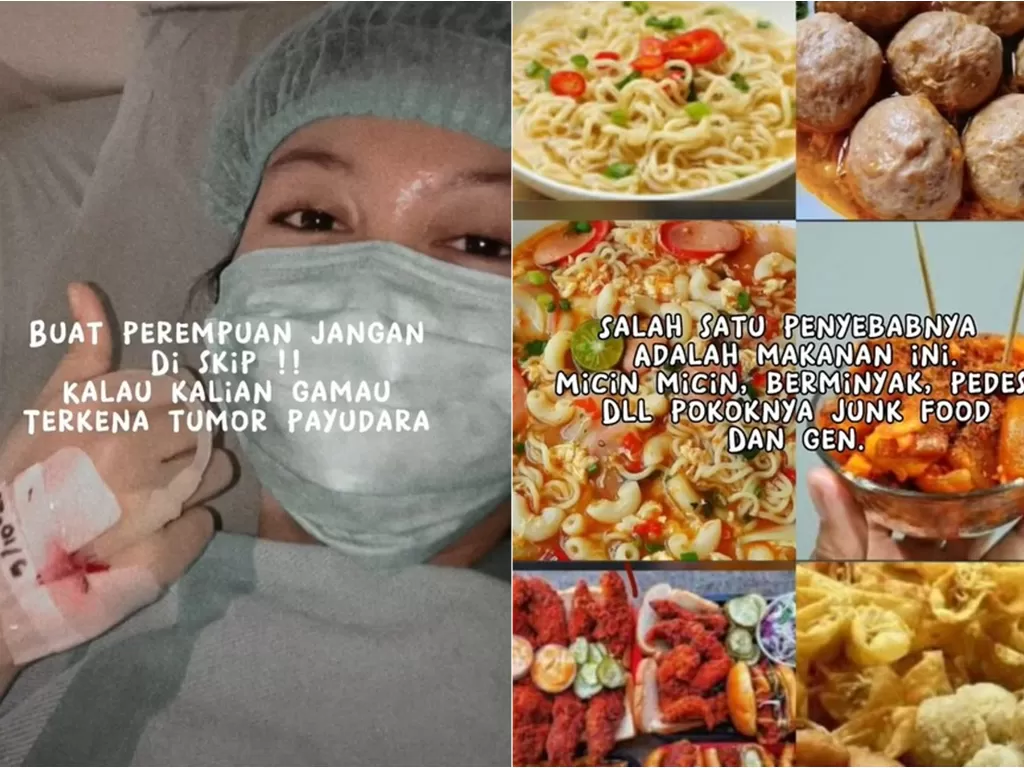 Wanita kena tumor payudara akibat sering makan junk food. (TikTok/@dayy.ayya)