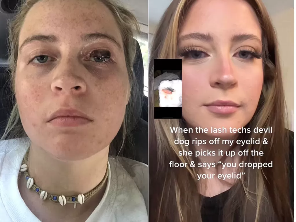 Wanita yang kelopak matanya digigit anjing pemilik salon eyelash extension (TikTok/kelseyyreads )