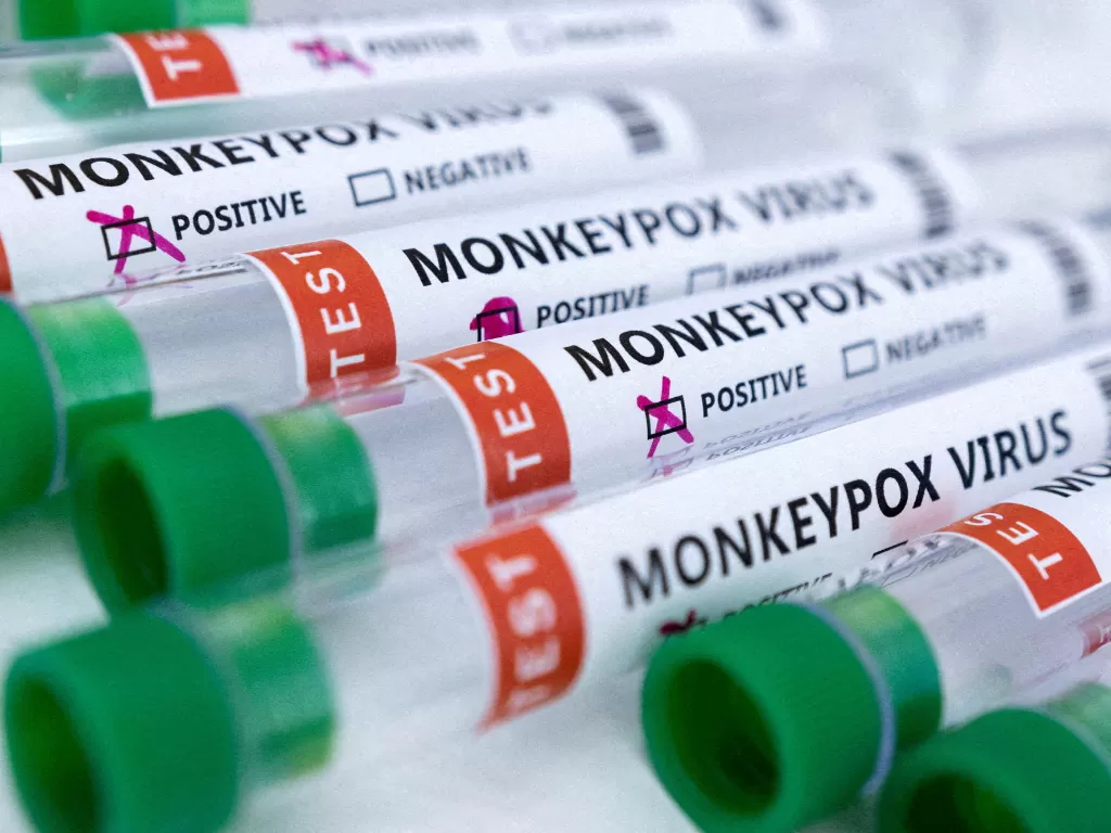 Kementerian Kesehatan Ukraina mengonfirmasi adanya kasus cacar monyet pertama. (REUTERS/Dado Ruvic)