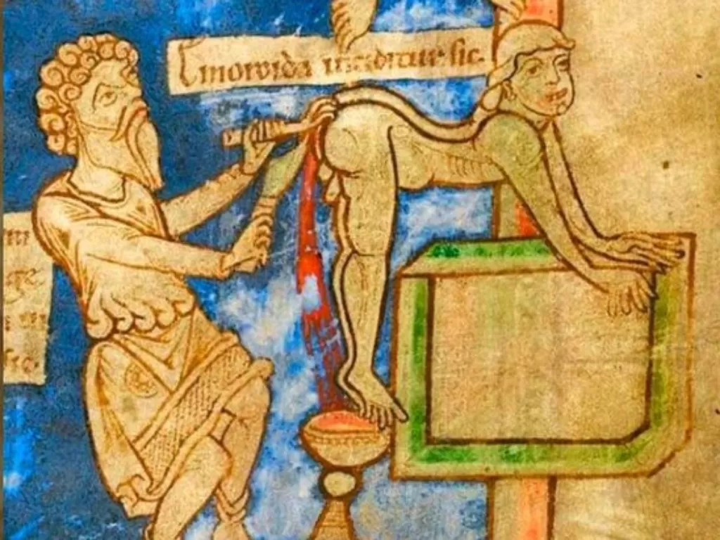 Ilustrasi pengobatan ambeien oleh tabib Yunani kuno dengan menggunakan besi panas. (The British Library)
