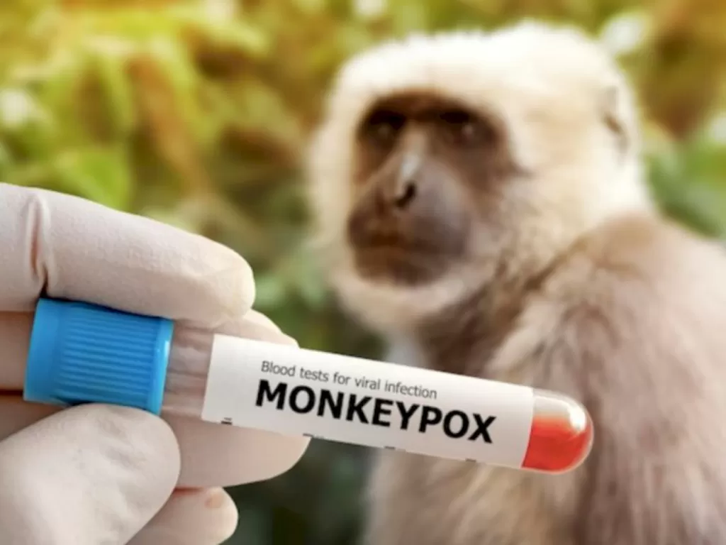 Ilustrasi virus cacar monyet (FREEPIK)