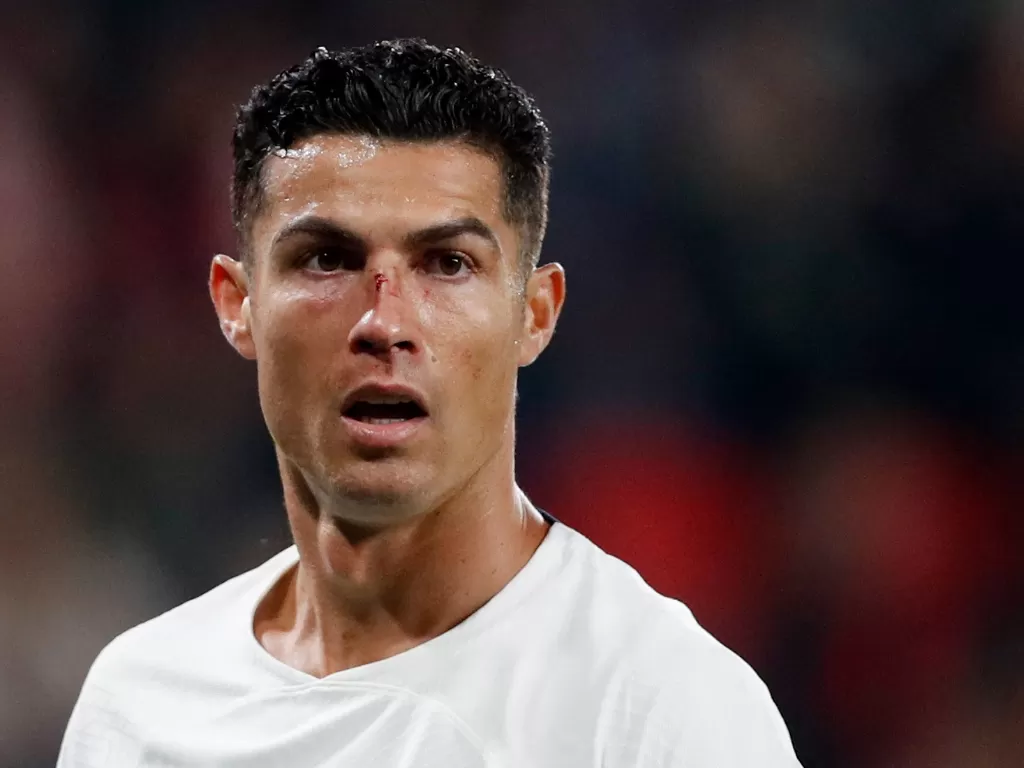 Cristiano Ronaldo dengan bekas luka di hidung akibat benturan dengan kiper Republik Ceko saat membela Portugal di UEFA Nations League, Minggu (25/9/2022). (REUTERS/David W Cerny)