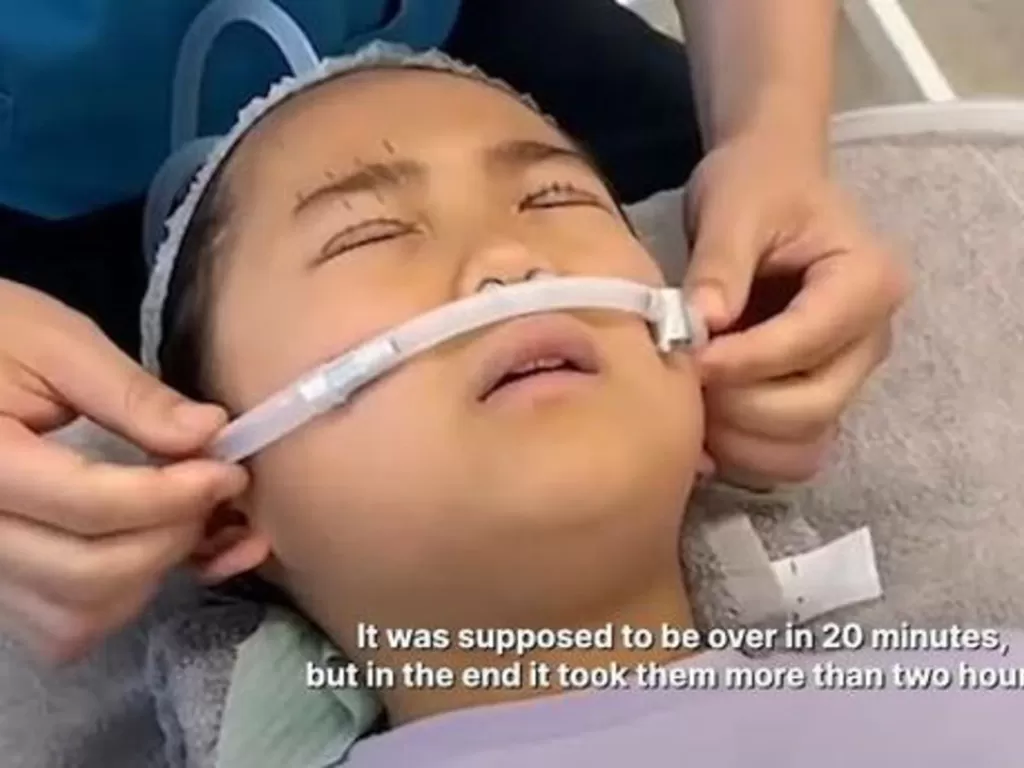 Gadis 9 tahun jalani operasi kelopak mata. (YouTube/VICE Asia)