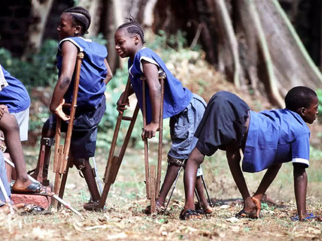 Ilustrasi anak pengidap polio di Sierra Leone. (Dok. WHO)