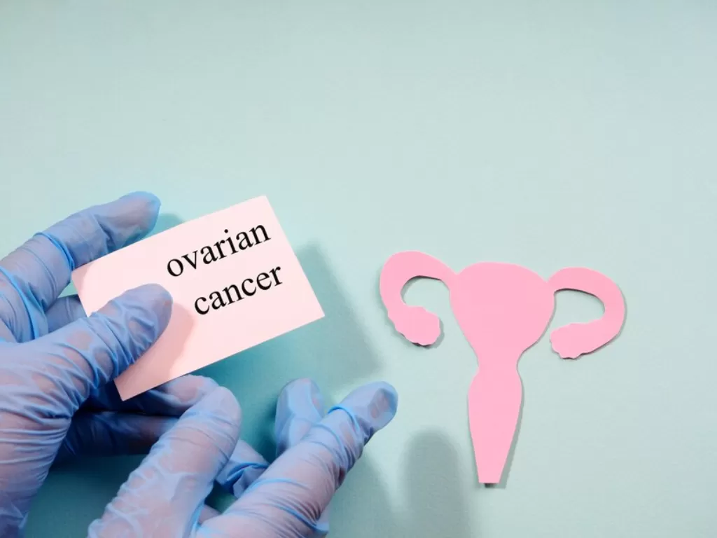 Ilustrasi kanker ovarium. (FREEPIK/allasaa)