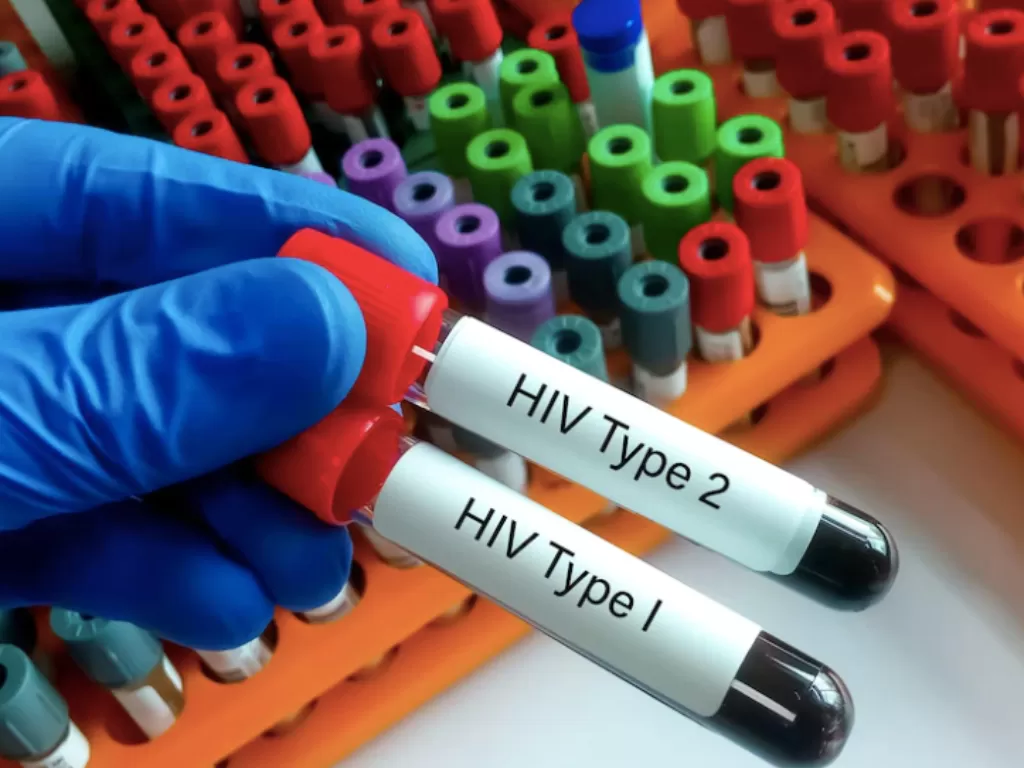 Ilustrasi sampel darah untuk tes HIV. (Freepik)