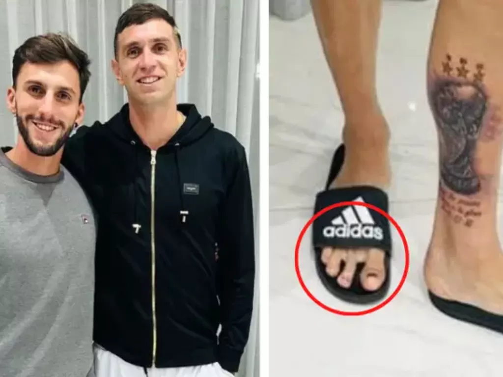 Diolok karena punya empat jari kaki, Emiliano Martinez tetap gacor! (Sportbible).