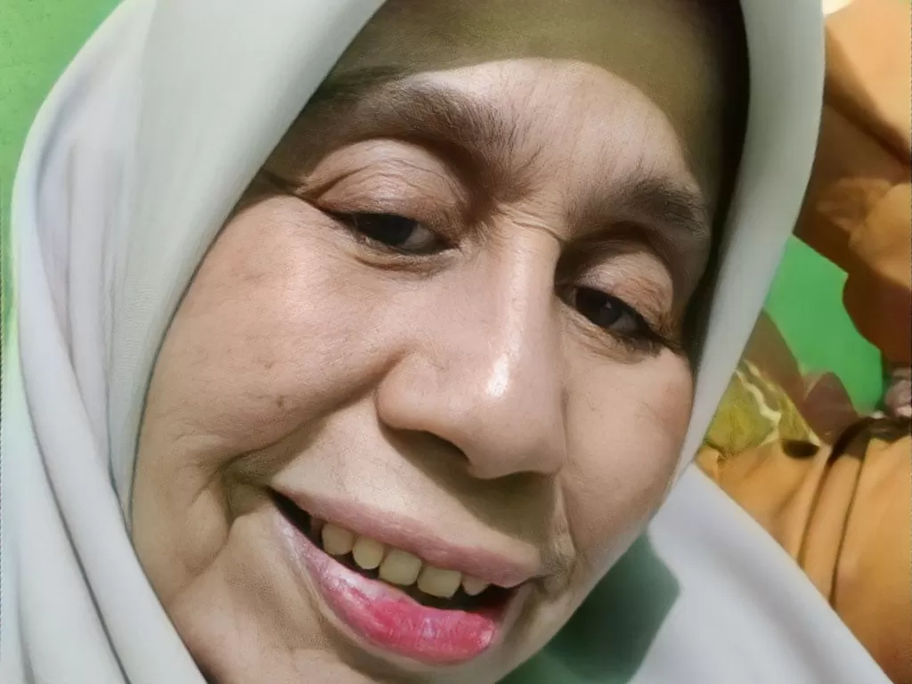 Viral Wajah Wanita 28 Tahun Lebih Tua Dari Usianya Ternyata Gejala