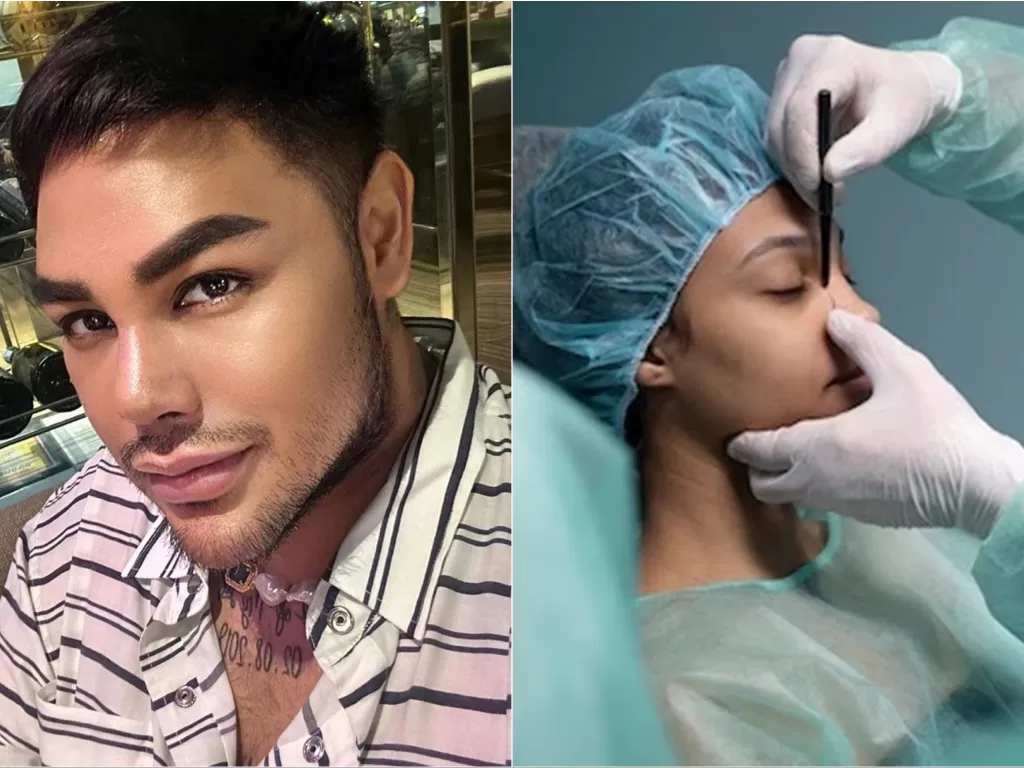 Kiri: Ivan Gunawan (Instagram/ivan_gunawan) / Kiri: Ilustrasi orang operasi hidung (Freepik)