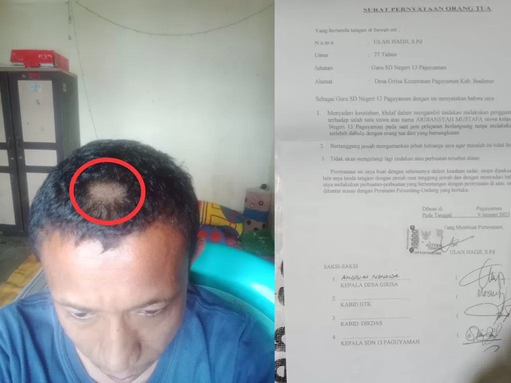Penampakan rambut guru yang digunting paksa beserta surat damai kedua belah pihak (Facebook/Insan Dai)