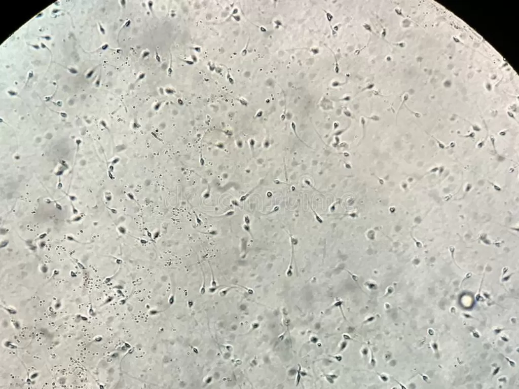 Jutaan sperma terlihat dengan mikroskop. (Dreams Time)