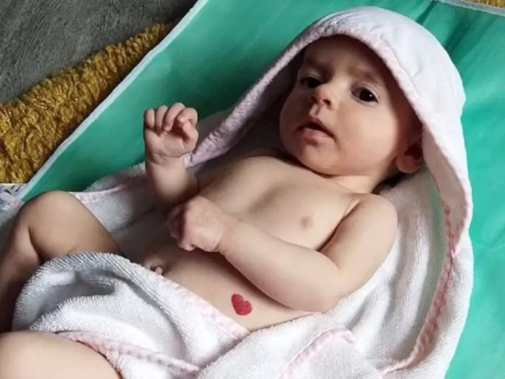 Bayi dengan tanda lahir berbentuk hati. (Dok. Caters via Daily Mail)