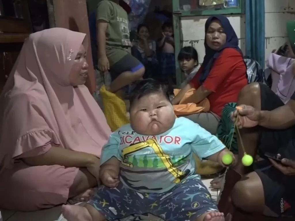 Balita obesitas di Bekasi dirujuk ke rumah sakit. (Z Creators/Ridwan)