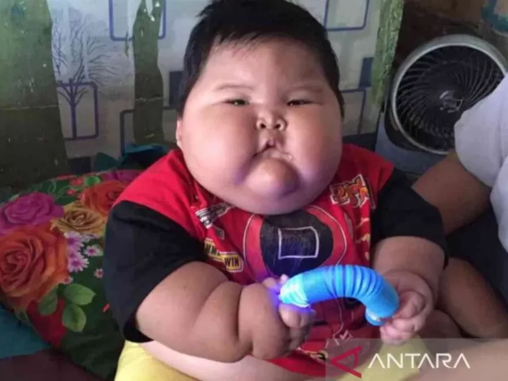 Balita obesitas Muhammad Kenzi Alvaro (ANTARA/Pradita Kurniawan Syah)
