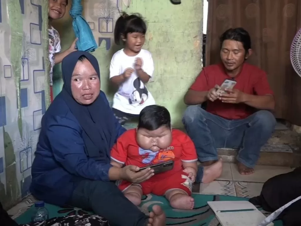  Balita obesitas di Bekasi, Muhammad Kenzi Alvaro (Z Creators/Ridwan)