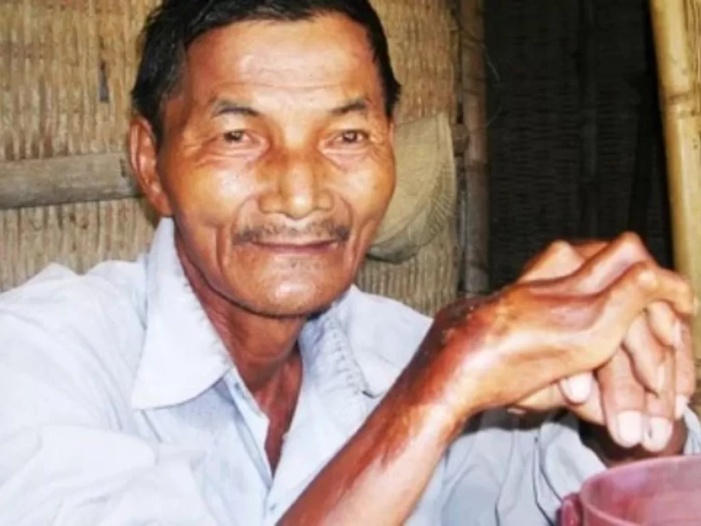 Thai Ngoc adalah pria Vietnam yang tak bisa tidur selama 50 tahun (Instagram)