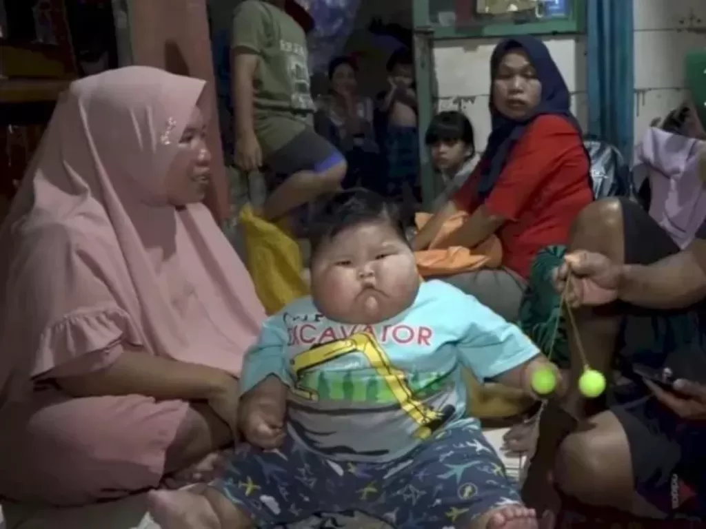 Bayi obesitas di Bekasi. (Z Creators/Ridwan)