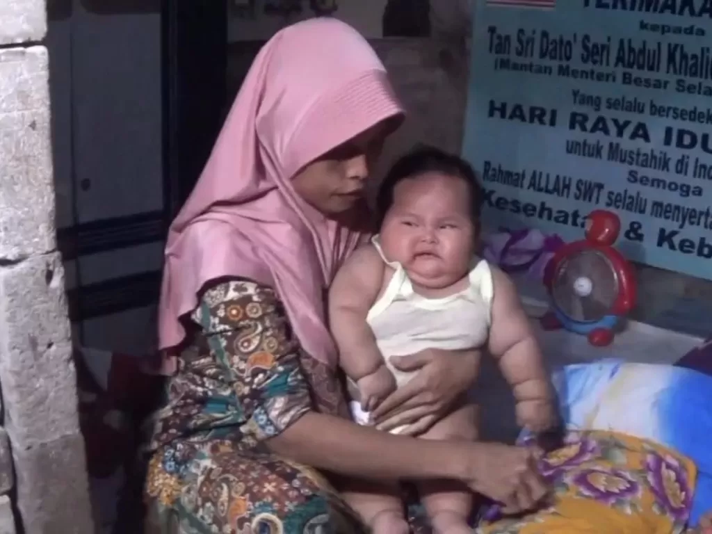 Bayi obesitas di Bekasi (Z Creators/Ridwan)