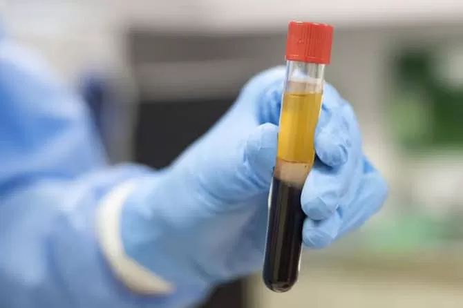 Ilmuwan Kembangkan Alat Deteksi Dini Kanker Melalui Tes Darah Jawa Pos