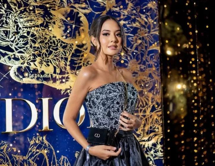 Aurelie Moeremans mengidap tumor colli sejak 3 bulan terakhir.  (Instagram/aurelie)