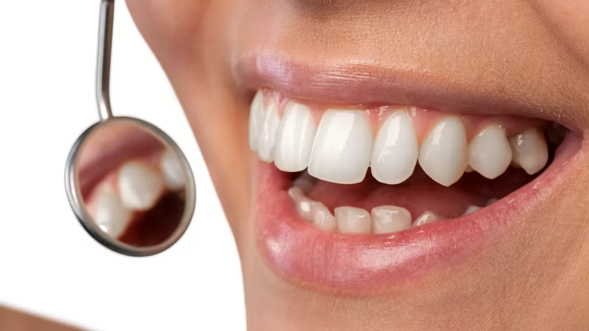 Teknik Mewing untuk gigi rapi. (Foto canva)