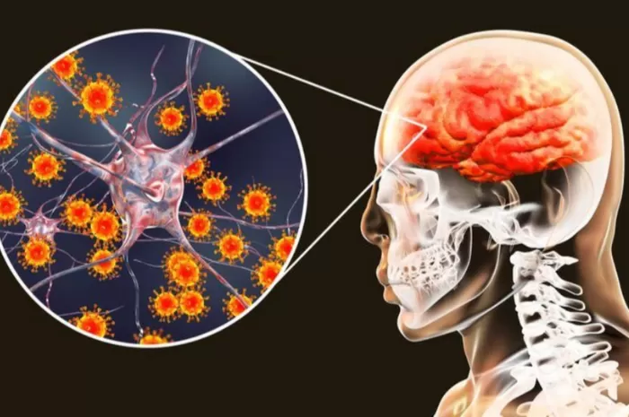 Ilustrasi Jenis Infeksi Parasit pada Otak ( Pixabay )