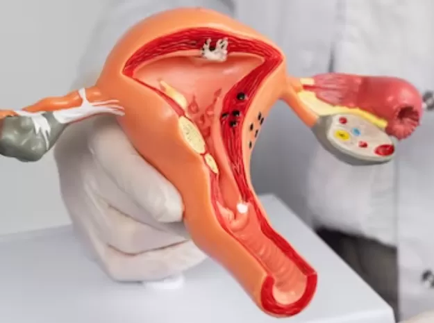 Gangguan Organ Reproduksi Wanita yang Berfungsi untuk Menghasilkan Sel Telur (freepik.com)