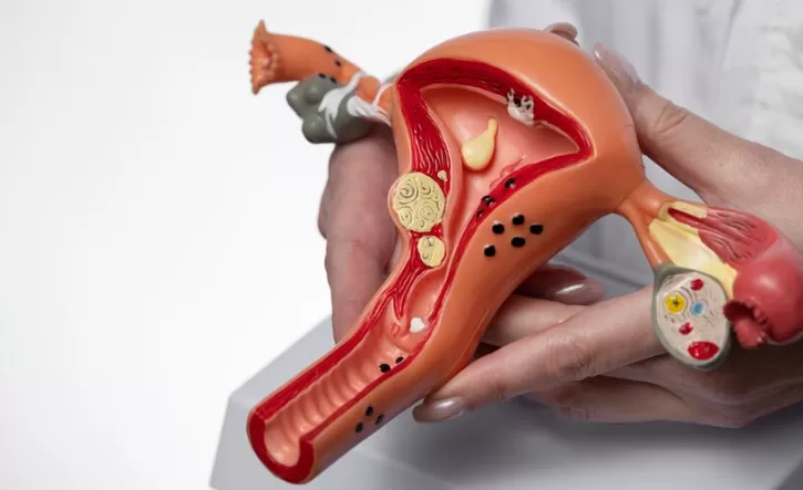 Organ Reproduksi Wanita yang Berfungsi untuk Menghasilkan Sel Telur (freepik.com)